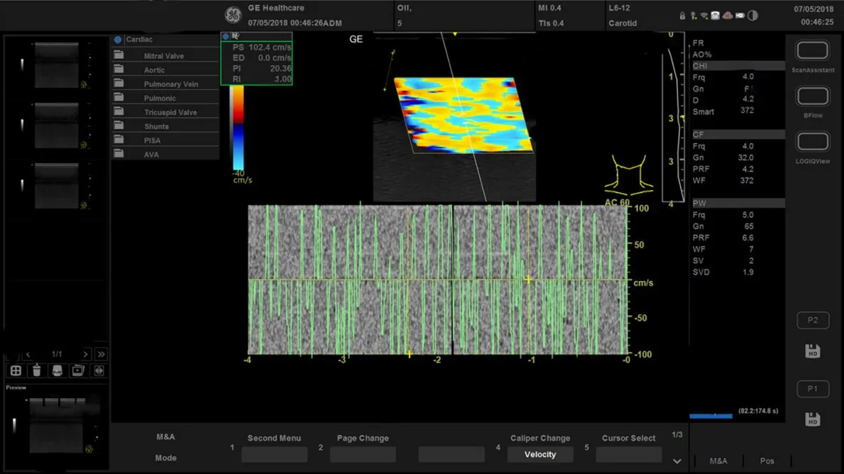 ge-versana-active-display